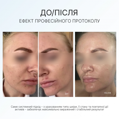 AG Skin Набір антивіковий Anti-age Set AG Skin Набір антивіковий Anti-age Set