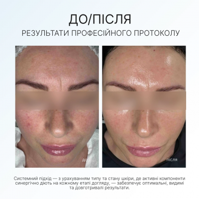 AG Skin Набір енергія вітамину С Vitamin C Set AG Skin Набір енергія вітамину С Vitamin C Set